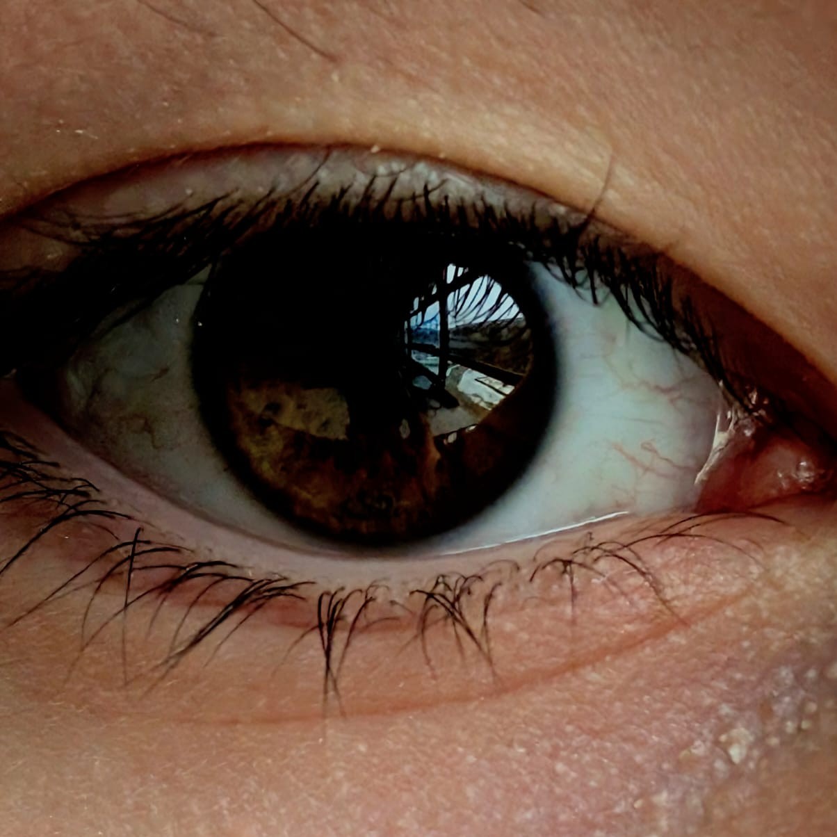 eye with brown iris